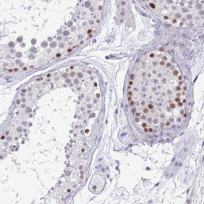 TIPIN Antibody in Immunohistochemistry (IHC)