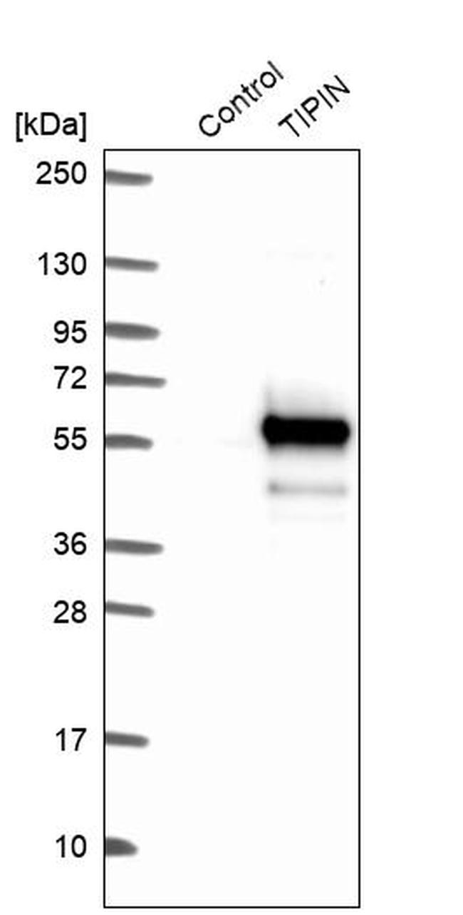 TIPIN Antibody in Western Blot (WB)