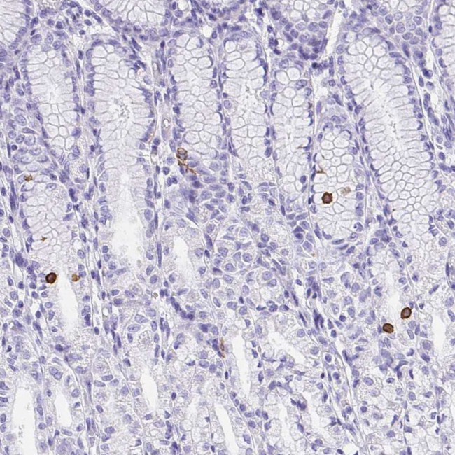 AVIL Antibody in Immunohistochemistry (IHC)