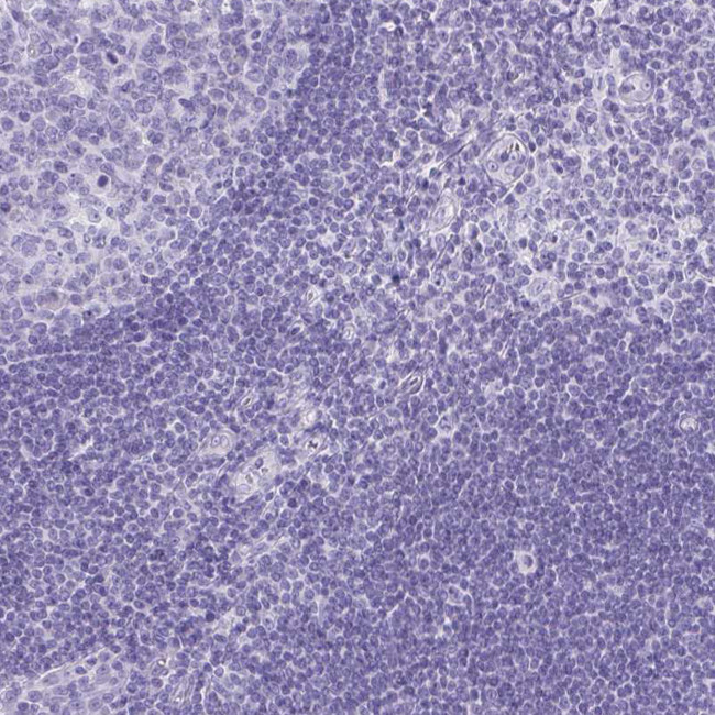 AVIL Antibody in Immunohistochemistry (IHC)