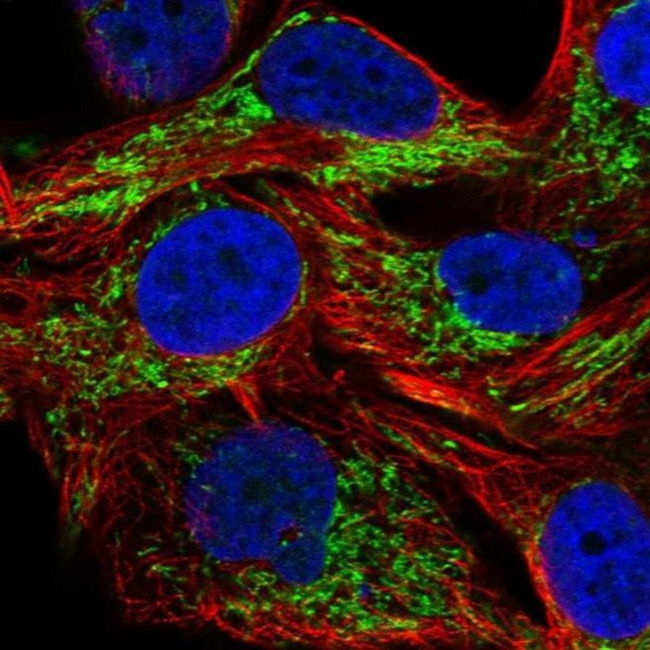 SAMD13 Antibody in Immunocytochemistry (ICC/IF)