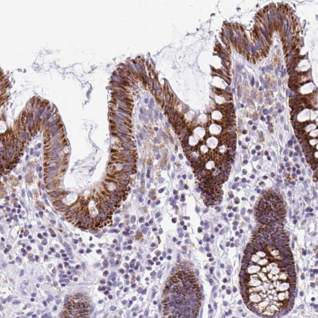 SAMD13 Antibody in Immunohistochemistry (IHC)