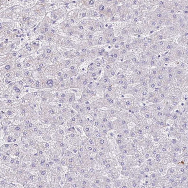 SAMD13 Antibody in Immunohistochemistry (IHC)