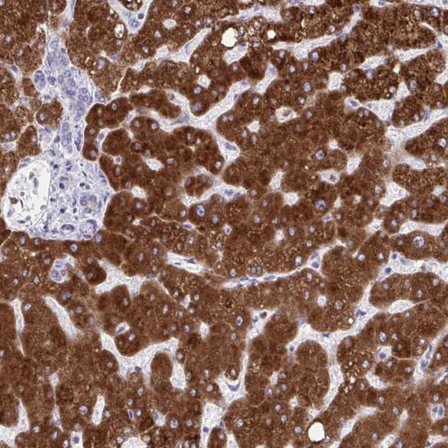 CYP4F2 Antibody in Immunohistochemistry (IHC)