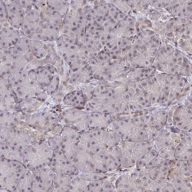 NIP7 Antibody in Immunohistochemistry (IHC)