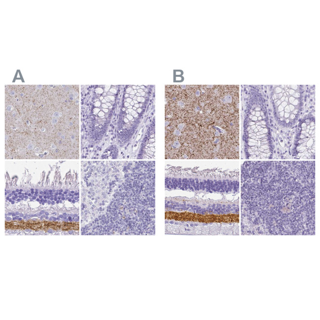 VGAT Antibody in Immunohistochemistry (IHC)