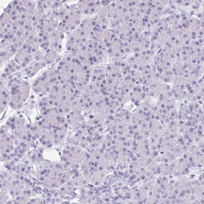 VGAT Antibody in Immunohistochemistry (IHC)