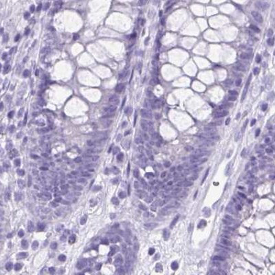 VGAT Antibody in Immunohistochemistry (IHC)