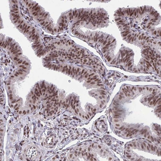 HOXA4 Antibody in Immunohistochemistry (IHC)