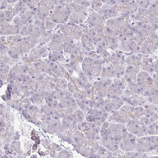 FN3K Antibody in Immunohistochemistry (IHC)