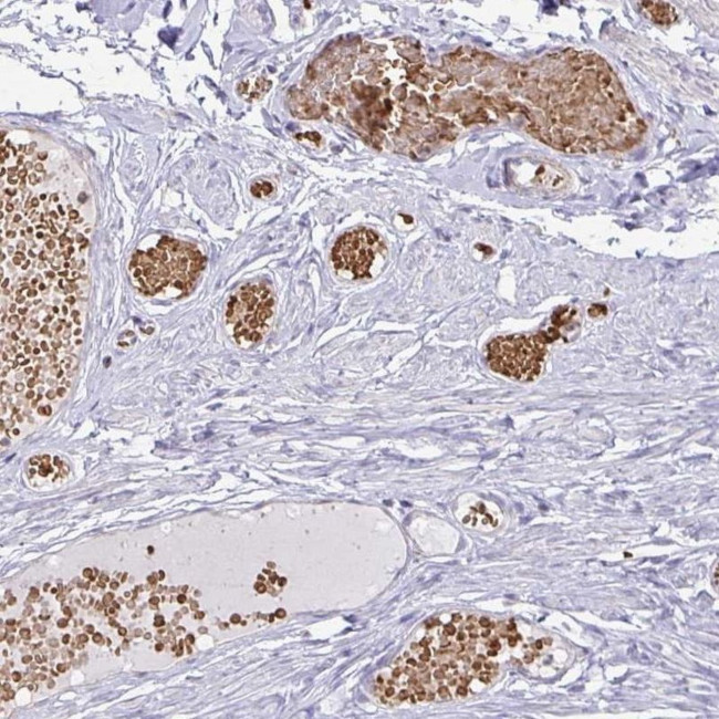 FN3K Antibody in Immunohistochemistry (IHC)