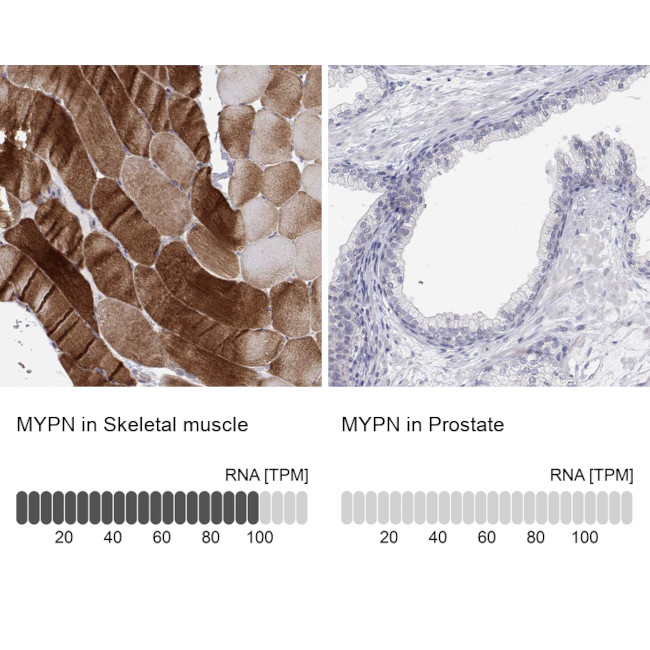 MYPN Antibody in Immunohistochemistry (IHC)