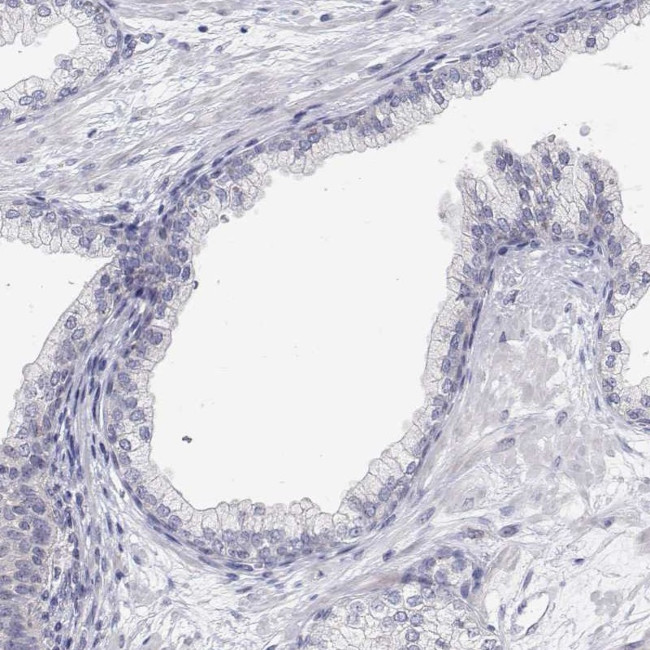 MYPN Antibody in Immunohistochemistry (IHC)