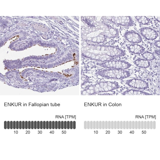 Enkurin Antibody in Immunohistochemistry (IHC)