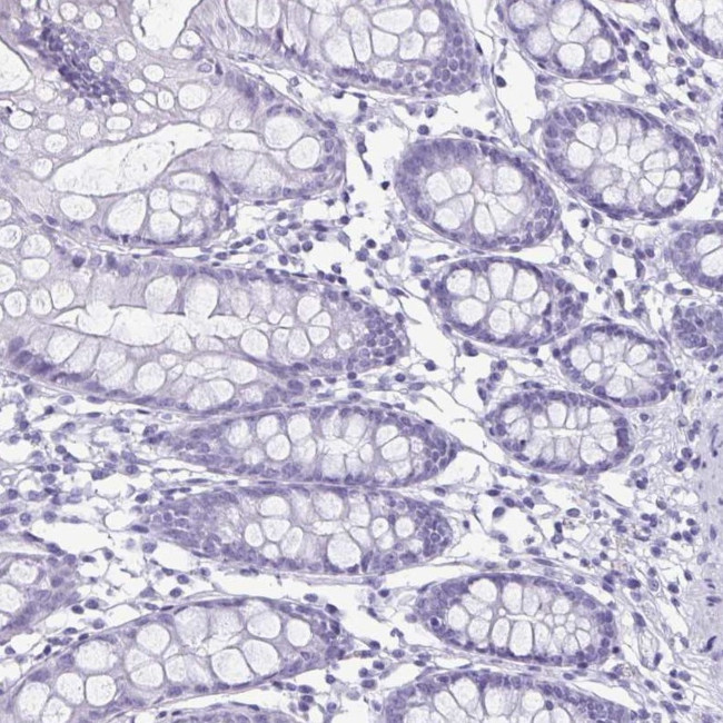 Enkurin Antibody in Immunohistochemistry (IHC)