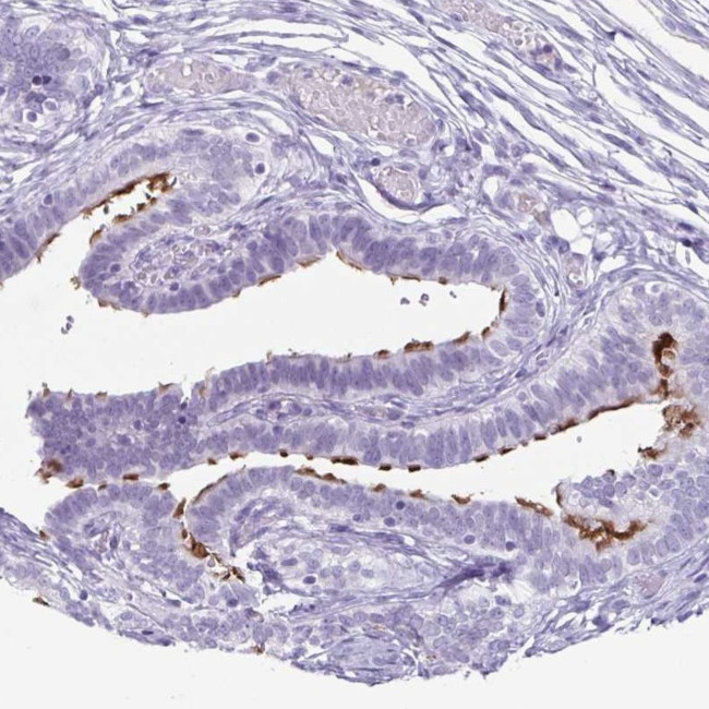 Enkurin Antibody in Immunohistochemistry (IHC)