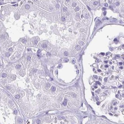 Enkurin Antibody in Immunohistochemistry (IHC)