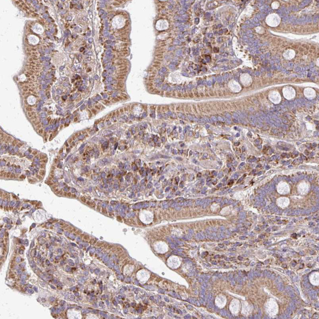 4E-BP2 Antibody in Immunohistochemistry (IHC)