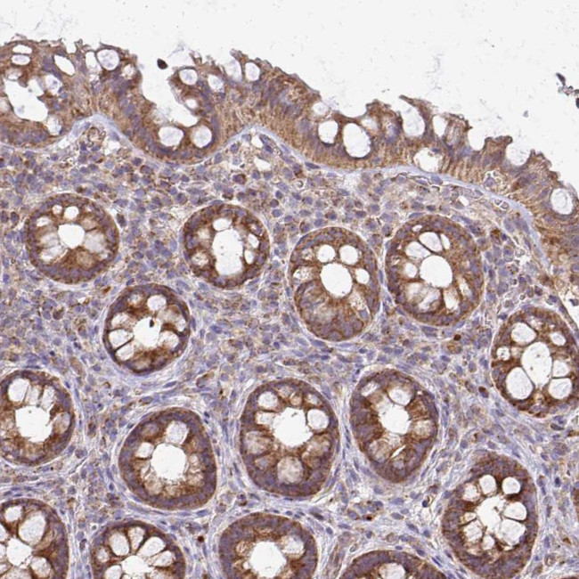 4E-BP2 Antibody in Immunohistochemistry (IHC)