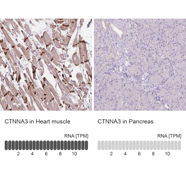 CTNNA3 Antibody in Immunohistochemistry (IHC)