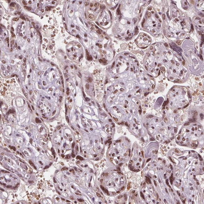 IWS1 Antibody in Immunohistochemistry (IHC)