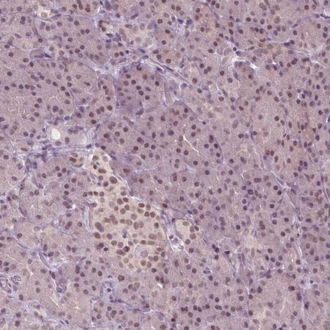 IWS1 Antibody in Immunohistochemistry (IHC)