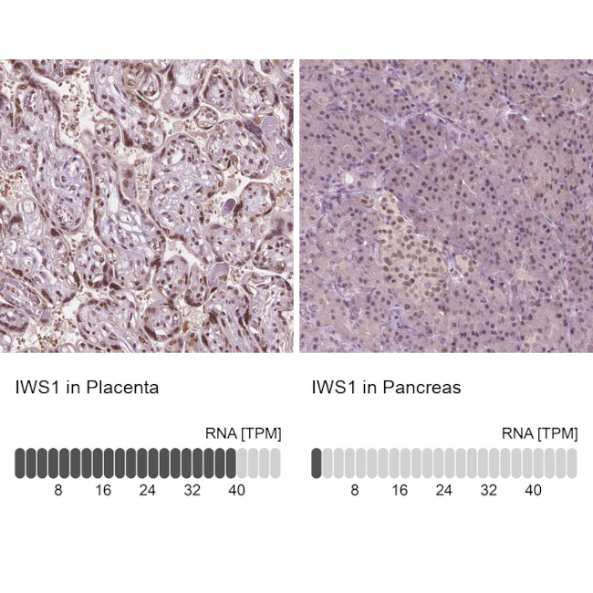 IWS1 Antibody