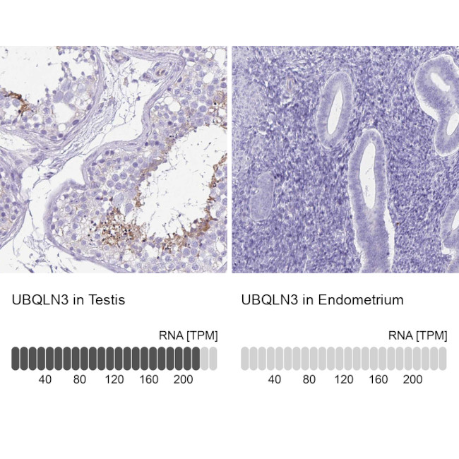 Ubiquilin 3 Antibody in Immunohistochemistry (IHC)