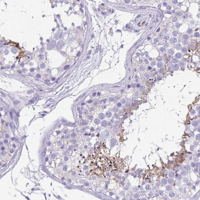 Ubiquilin 3 Antibody in Immunohistochemistry (IHC)