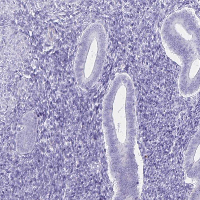 Ubiquilin 3 Antibody in Immunohistochemistry (IHC)