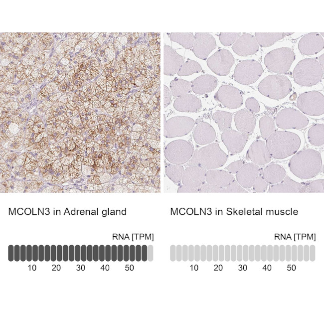 TRPML3 Antibody in Immunohistochemistry (IHC)