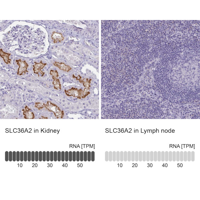 SLC36A2 Antibody in Immunohistochemistry (IHC)