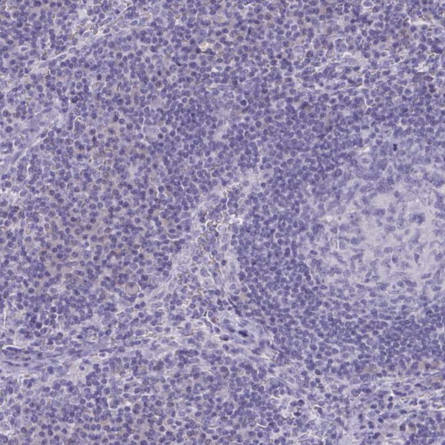 SLC36A2 Antibody in Immunohistochemistry (IHC)
