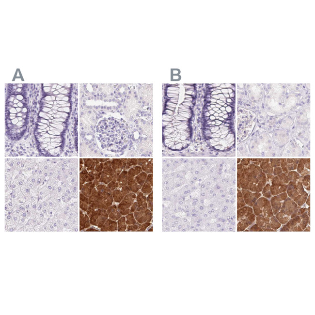 PNLIP Antibody in Immunohistochemistry (IHC)