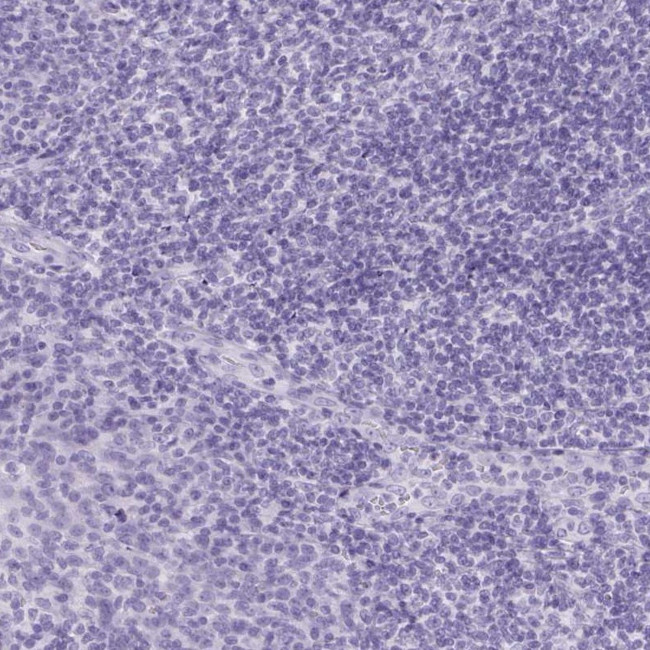 PNLIP Antibody in Immunohistochemistry (IHC)