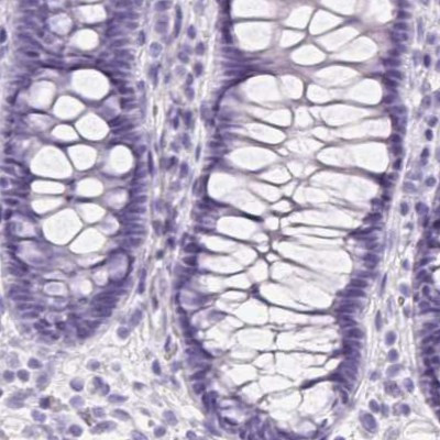 PNLIP Antibody in Immunohistochemistry (IHC)