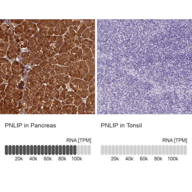 PNLIP Antibody