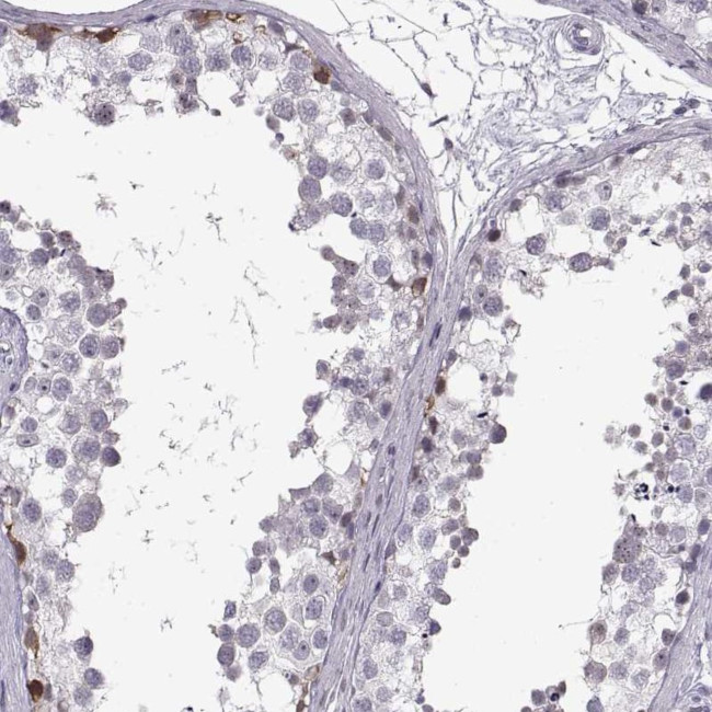 NANOS3 Antibody in Immunohistochemistry (IHC)