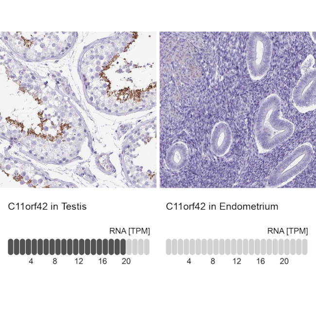 C11orf42 Antibody in Immunohistochemistry (IHC)
