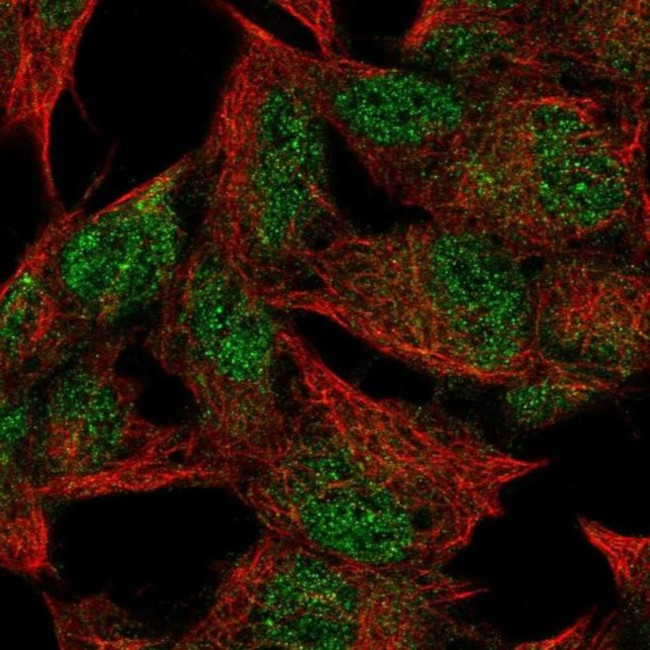 FNDC4 Antibody in Immunocytochemistry (ICC/IF)