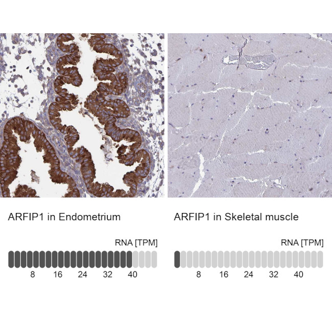 Arfaptin 1 Antibody in Immunohistochemistry (IHC)