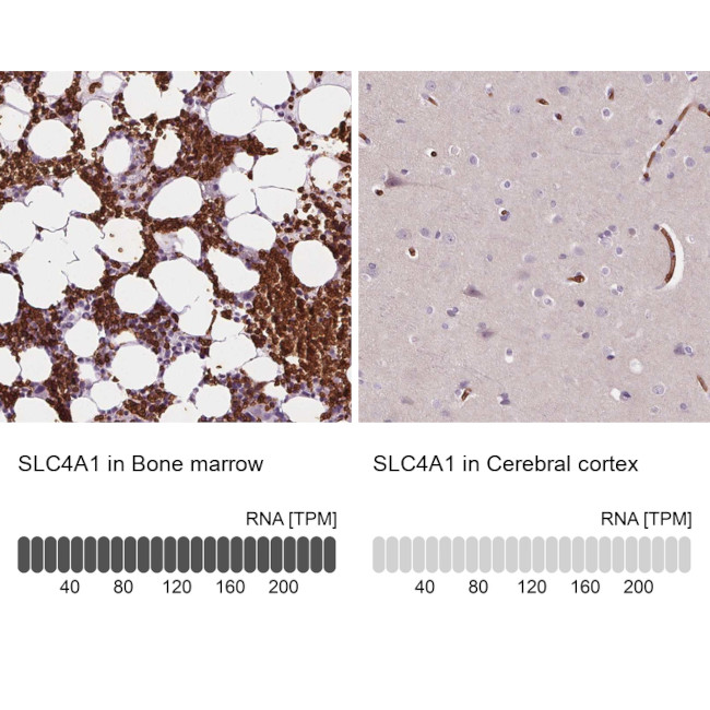 SLC4A1 Antibody in Immunohistochemistry (IHC)