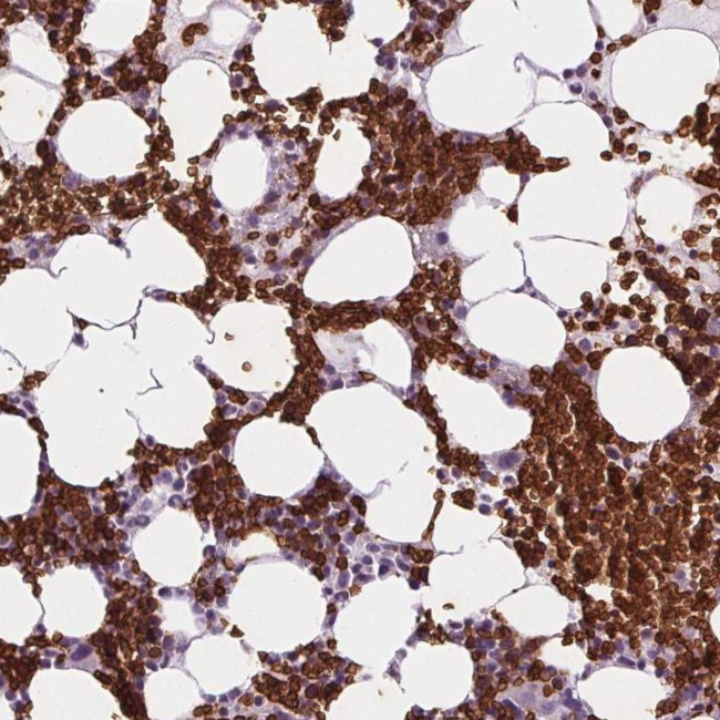 SLC4A1 Antibody in Immunohistochemistry (IHC)