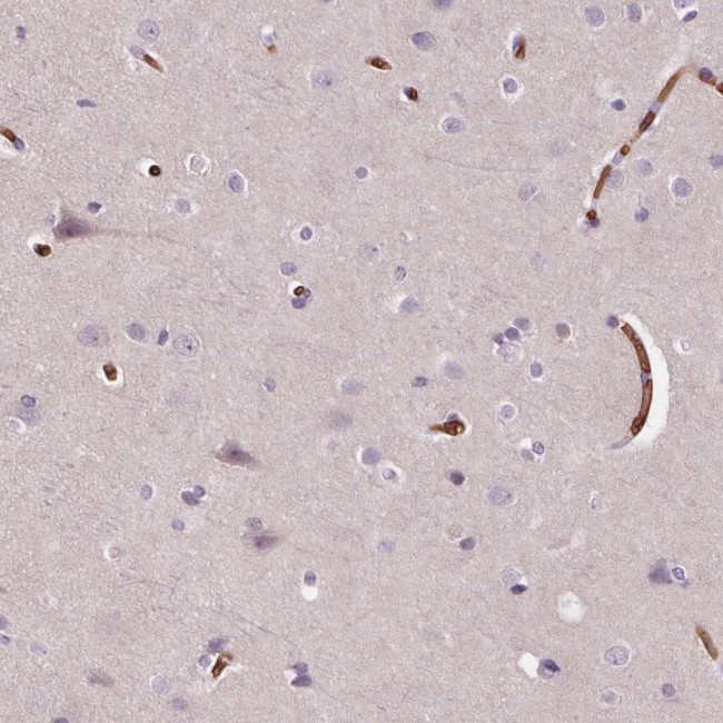 SLC4A1 Antibody in Immunohistochemistry (IHC)