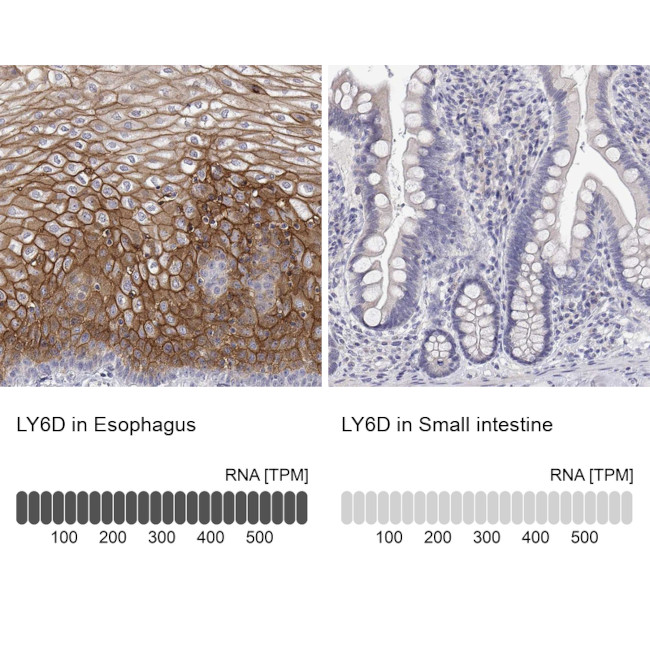 LY6D Antibody in Immunohistochemistry (IHC)