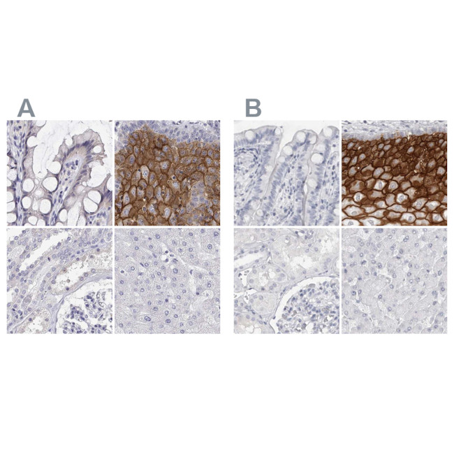 LY6D Antibody in Immunohistochemistry (IHC)