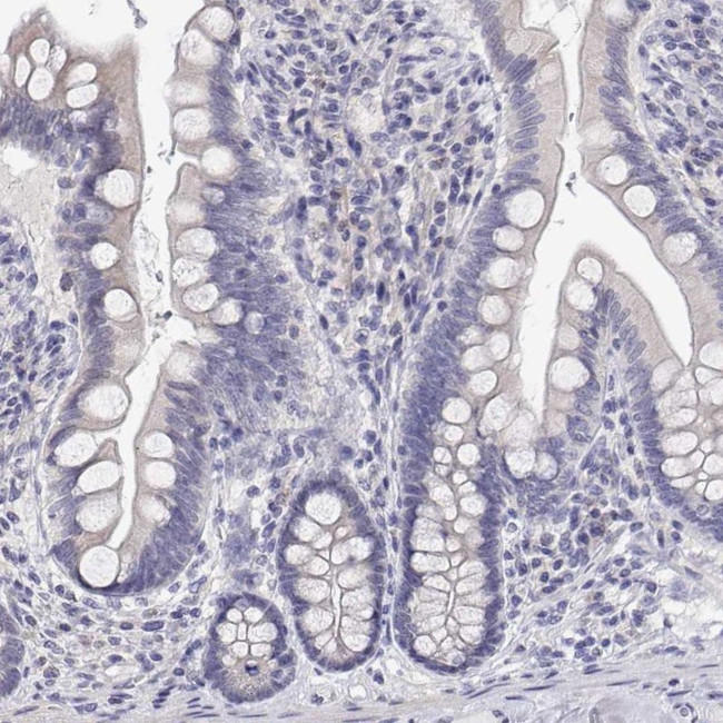 LY6D Antibody in Immunohistochemistry (IHC)