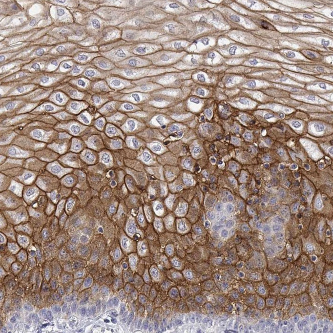 LY6D Antibody in Immunohistochemistry (IHC)