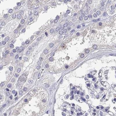 LY6D Antibody in Immunohistochemistry (IHC)