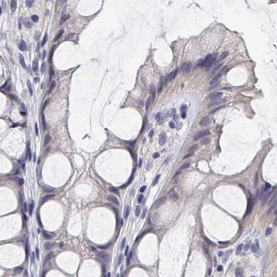 LY6D Antibody in Immunohistochemistry (IHC)